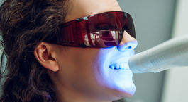 Gondolkodsz a fogfehérítésen? 7 ok, amiért érdemes ellátogatnod a fogorvoshoz!